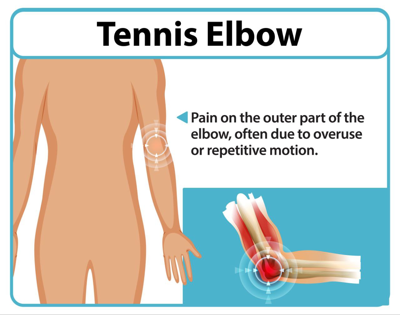 Ayurvedic treatment for tennis elbow